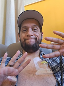 Chris Rodriguez, patient diagnosed with early-onset colorectal cancer at age 35, holds up fingers