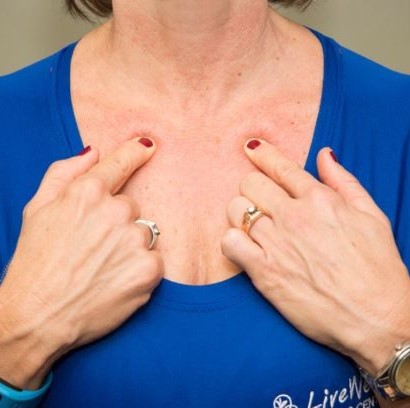 hiccup_acupressure_point_chest