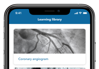 Patient education about the heart on a mobile screen